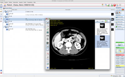 DICOM Image Processing